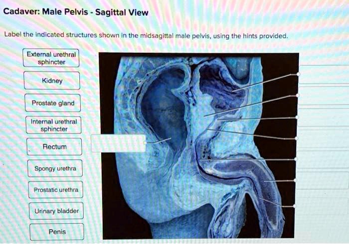 Label the midsagittal male pelvis using the hints provided.