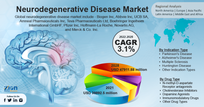 Jeremy has parkinson's disease a progressive neurodegenerative