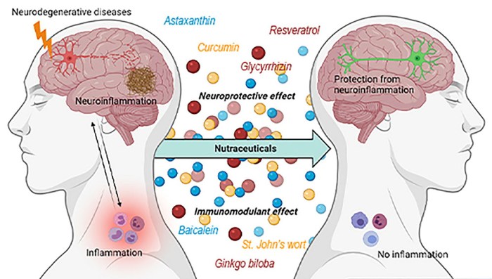 Jeremy has parkinson's disease a progressive neurodegenerative