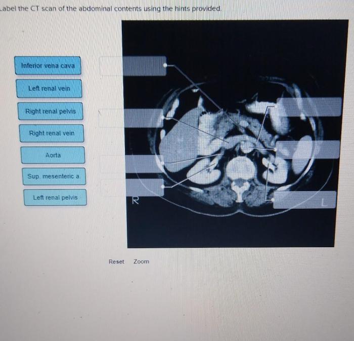 Label the midsagittal male pelvis using the hints provided.